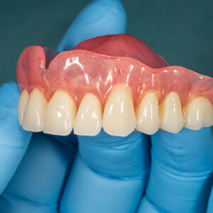 A close-up of a gloved hand holding an upper denture